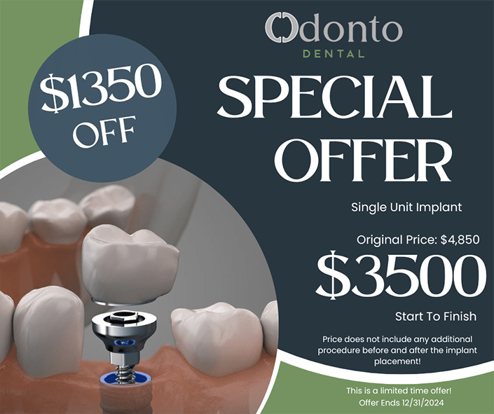 dental implant promotion details