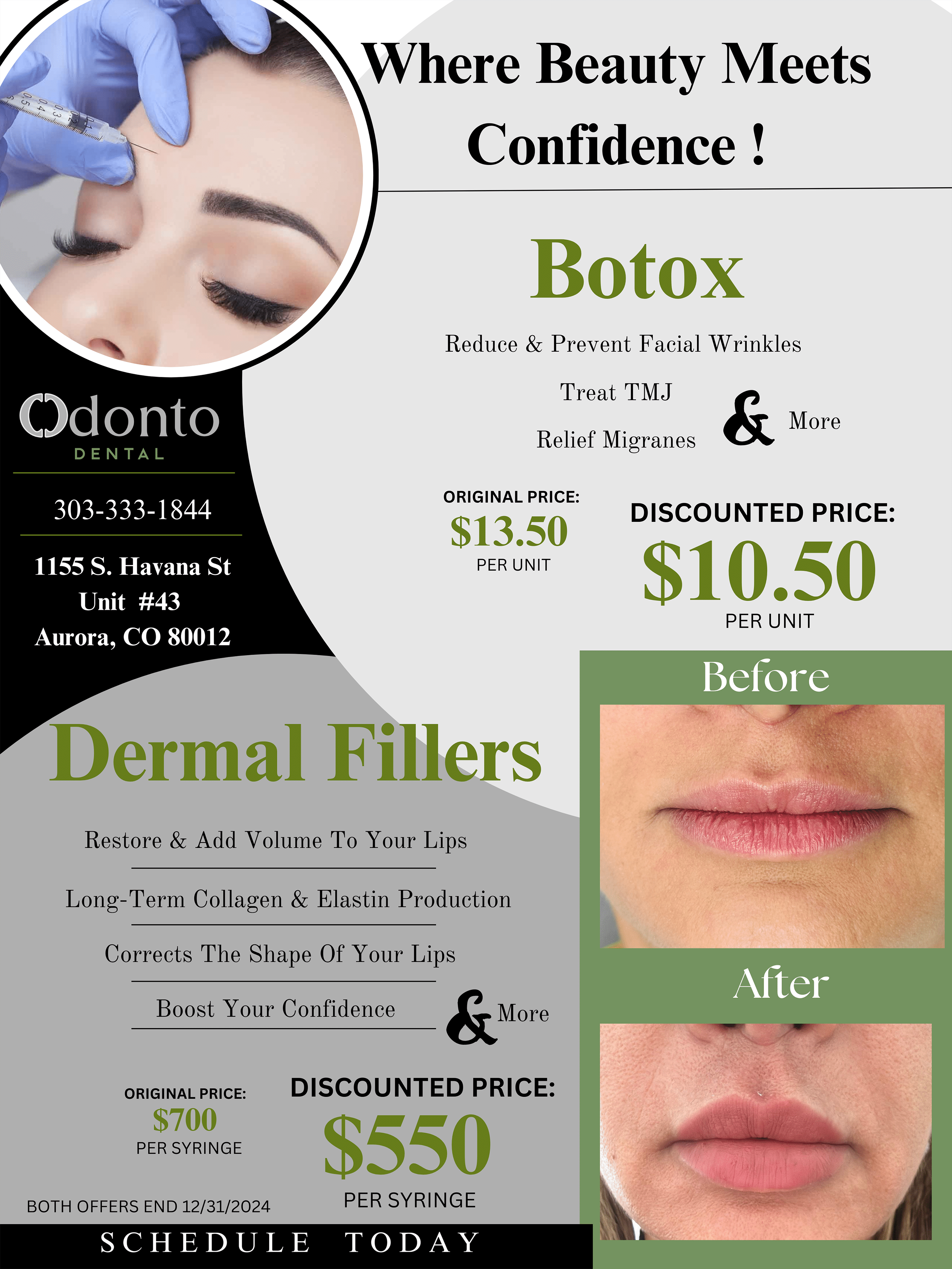 botox promotion details at odonto dental