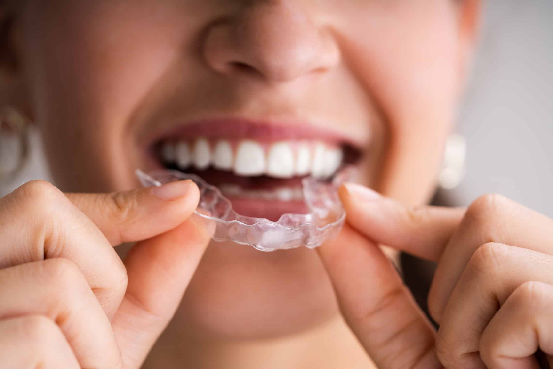 dental patient trying clear aligner during invisalign consultation in aurora co