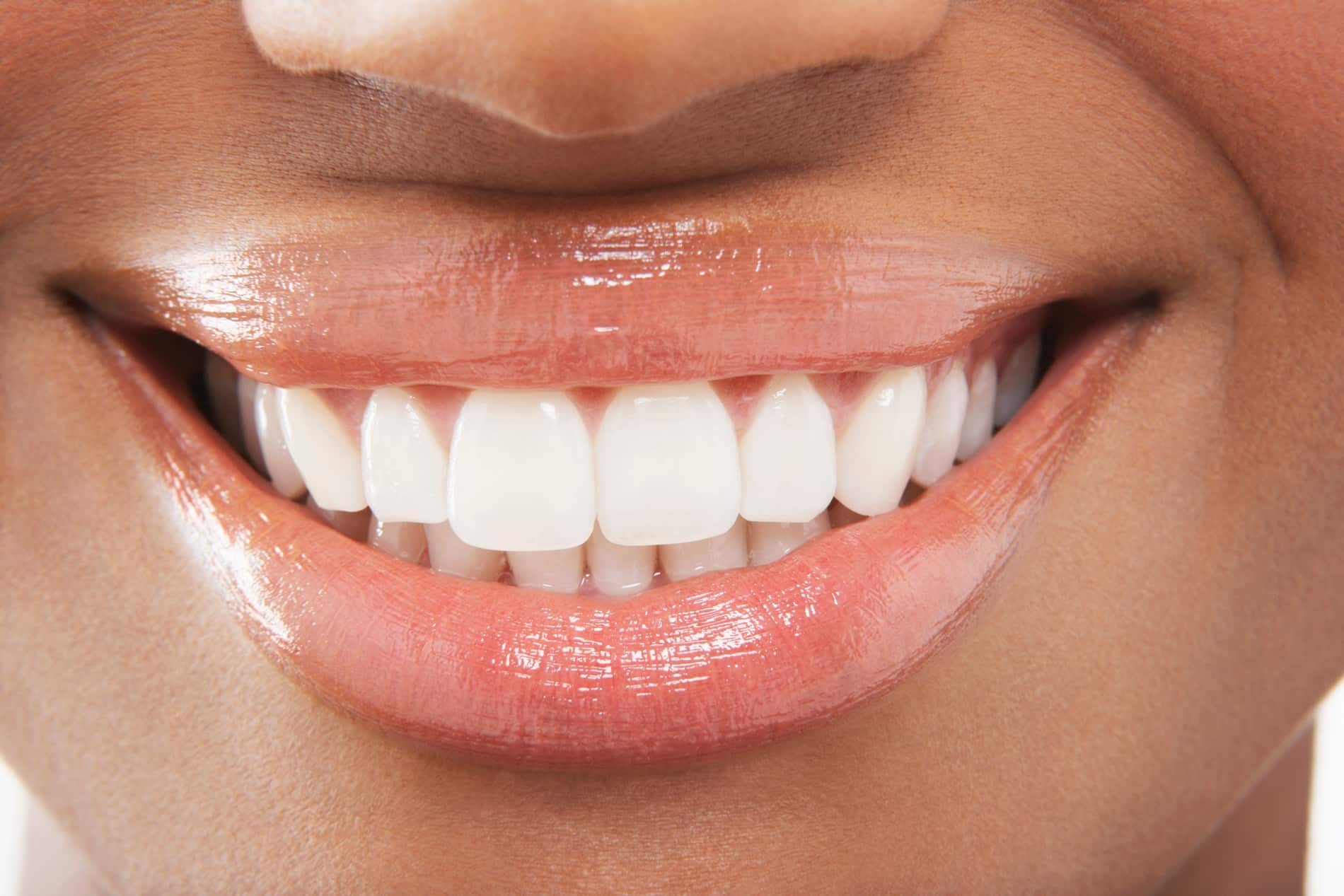 Woman smiling at her oral exam at Odonto Dental