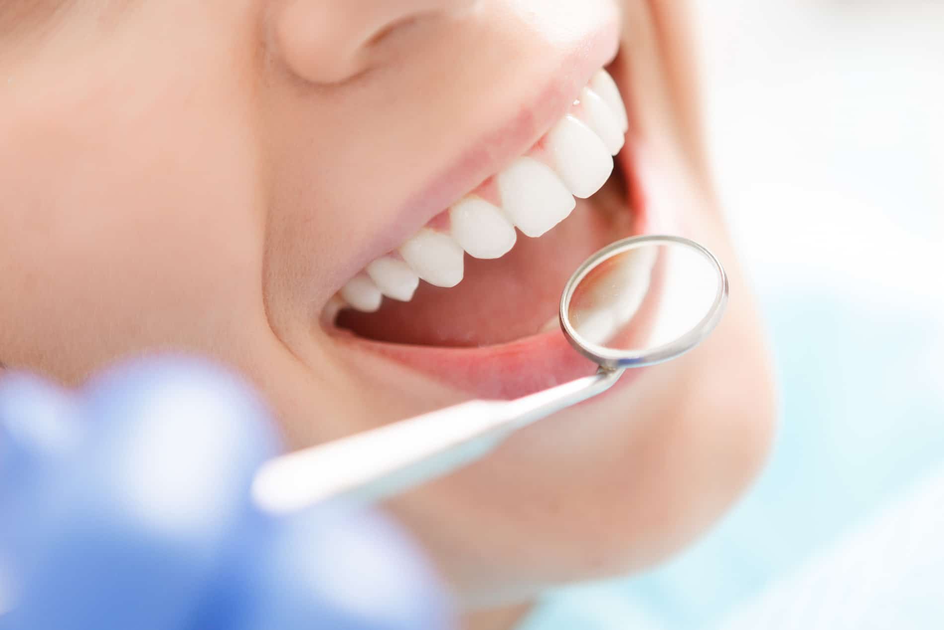 Woman has nitrous oxide sedation at Odonto Dental