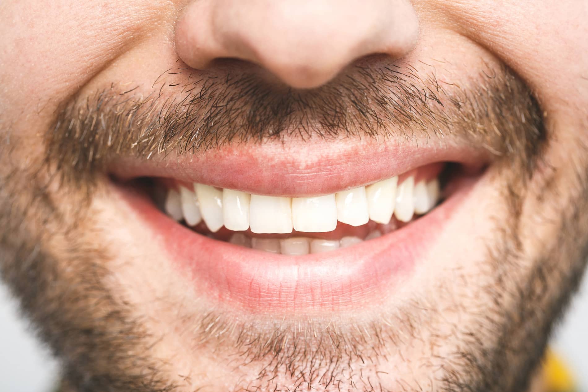 Man with aperfect smile after extraction with Dr. Castro in Aurora