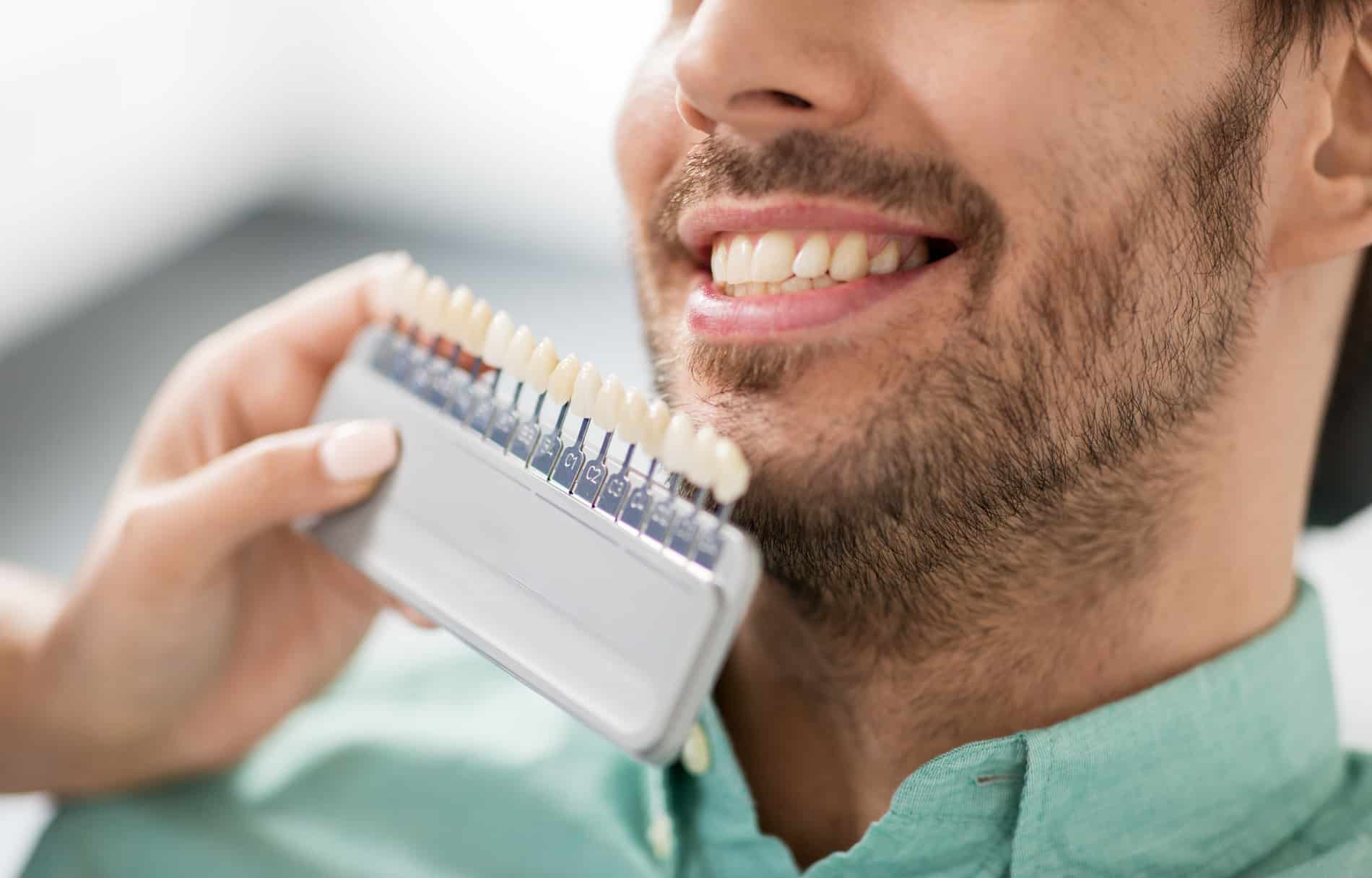 Man at his first veneer consultation in Aurora CO